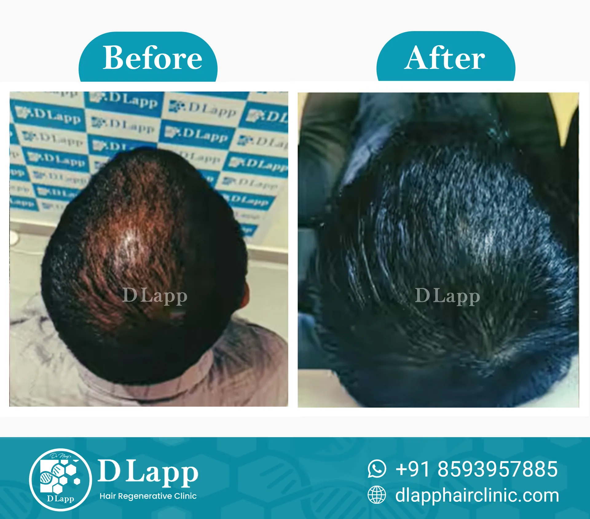 Before/After Medical Image