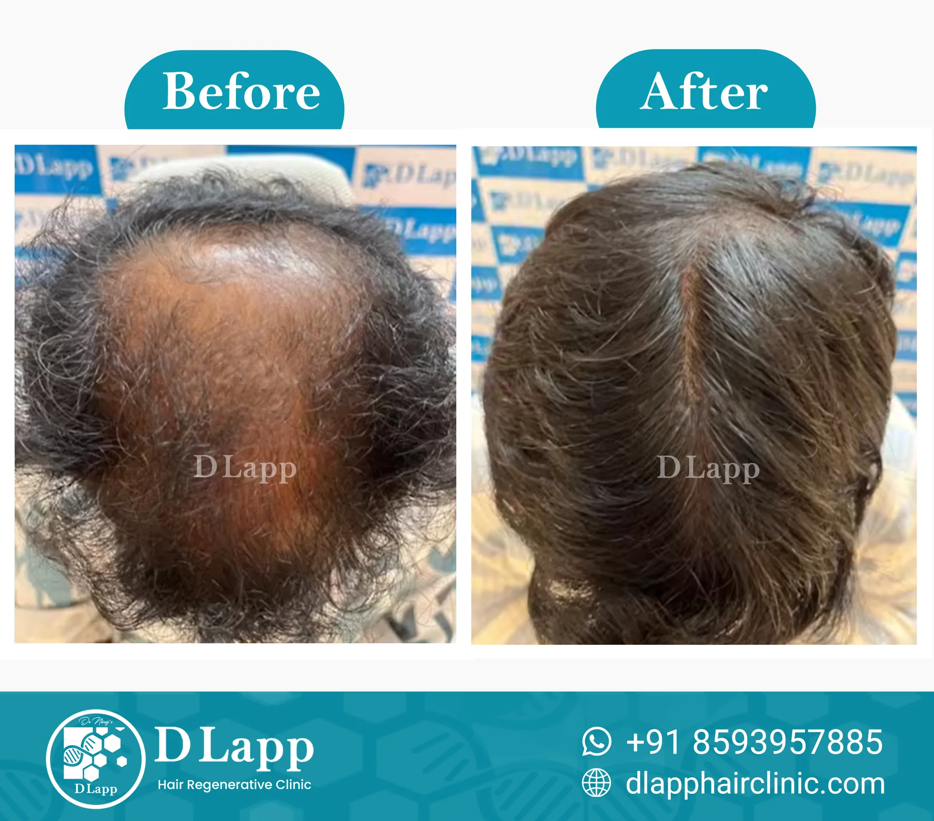 Before/After Medical Image