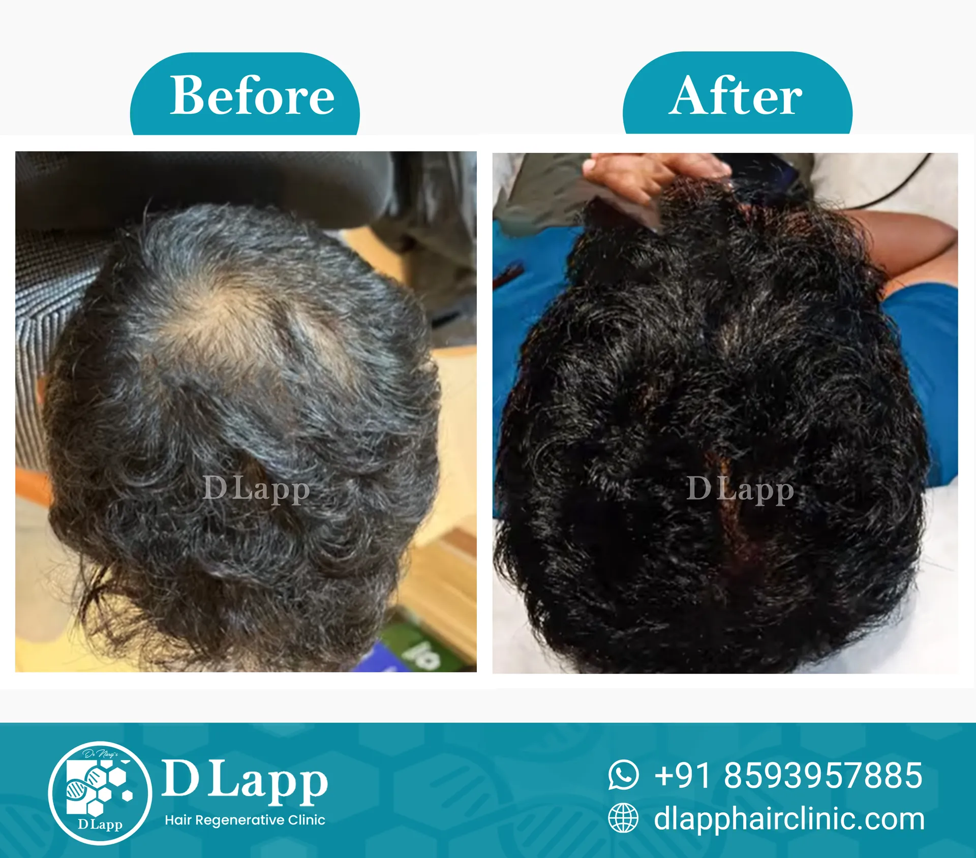 Before/After Medical Image