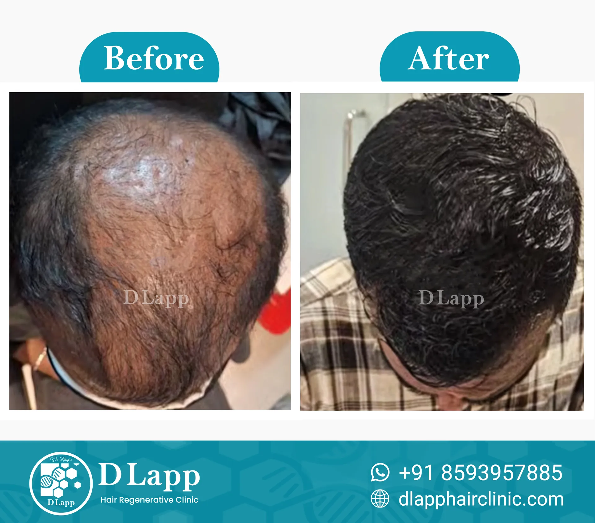 Before/After Medical Image