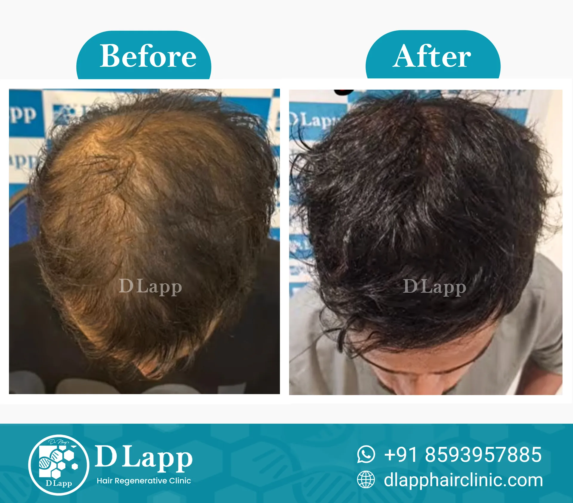 Before/After Medical Image