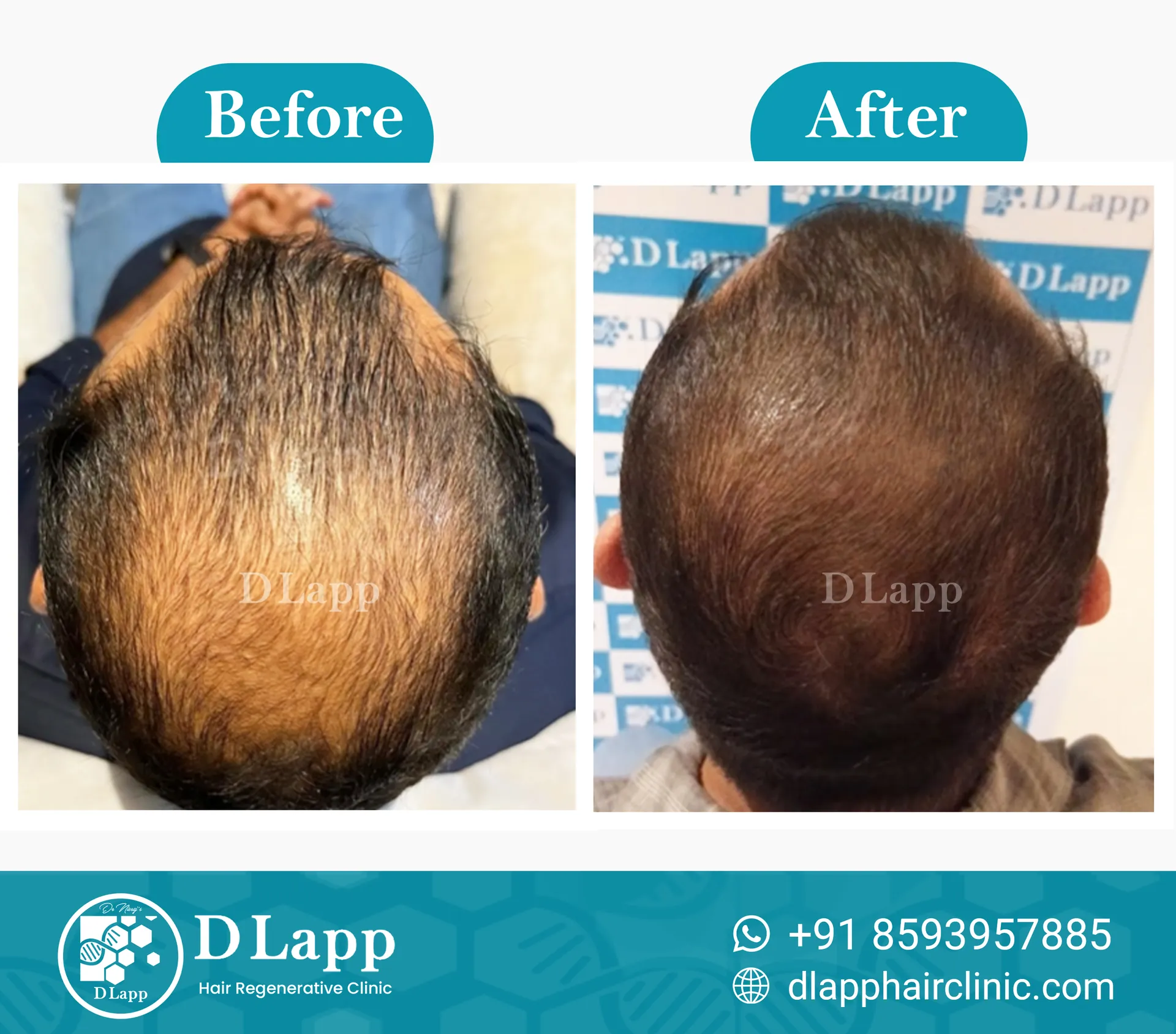 Before/After Medical Image
