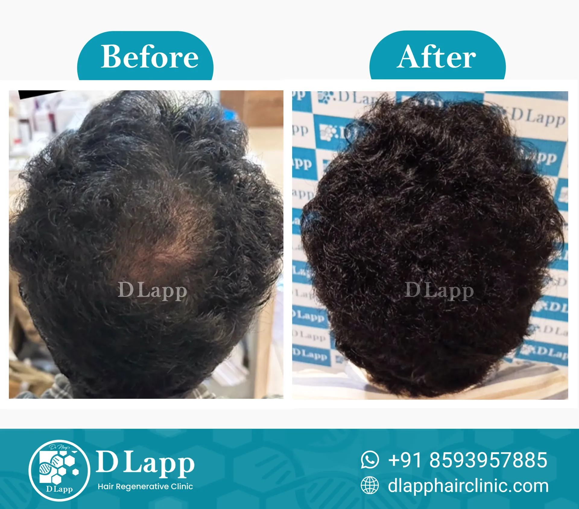 Before/After Medical Image