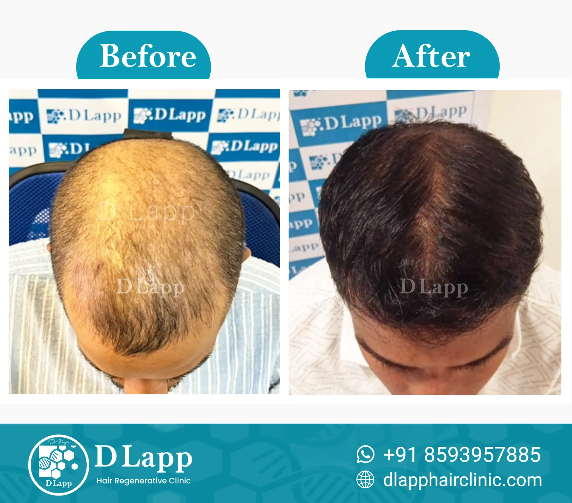 Before/After Medical Image