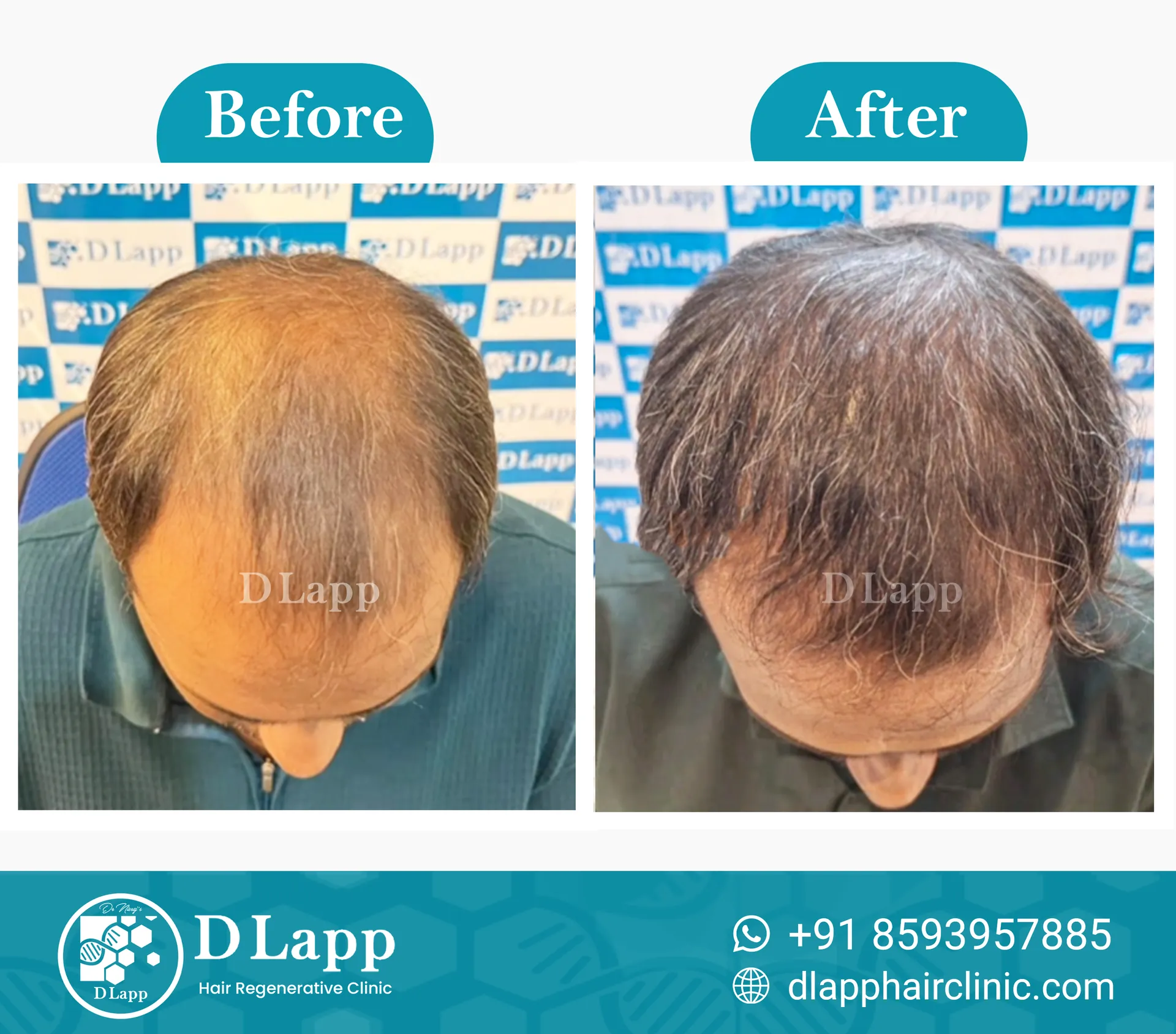 Before/After Medical Image