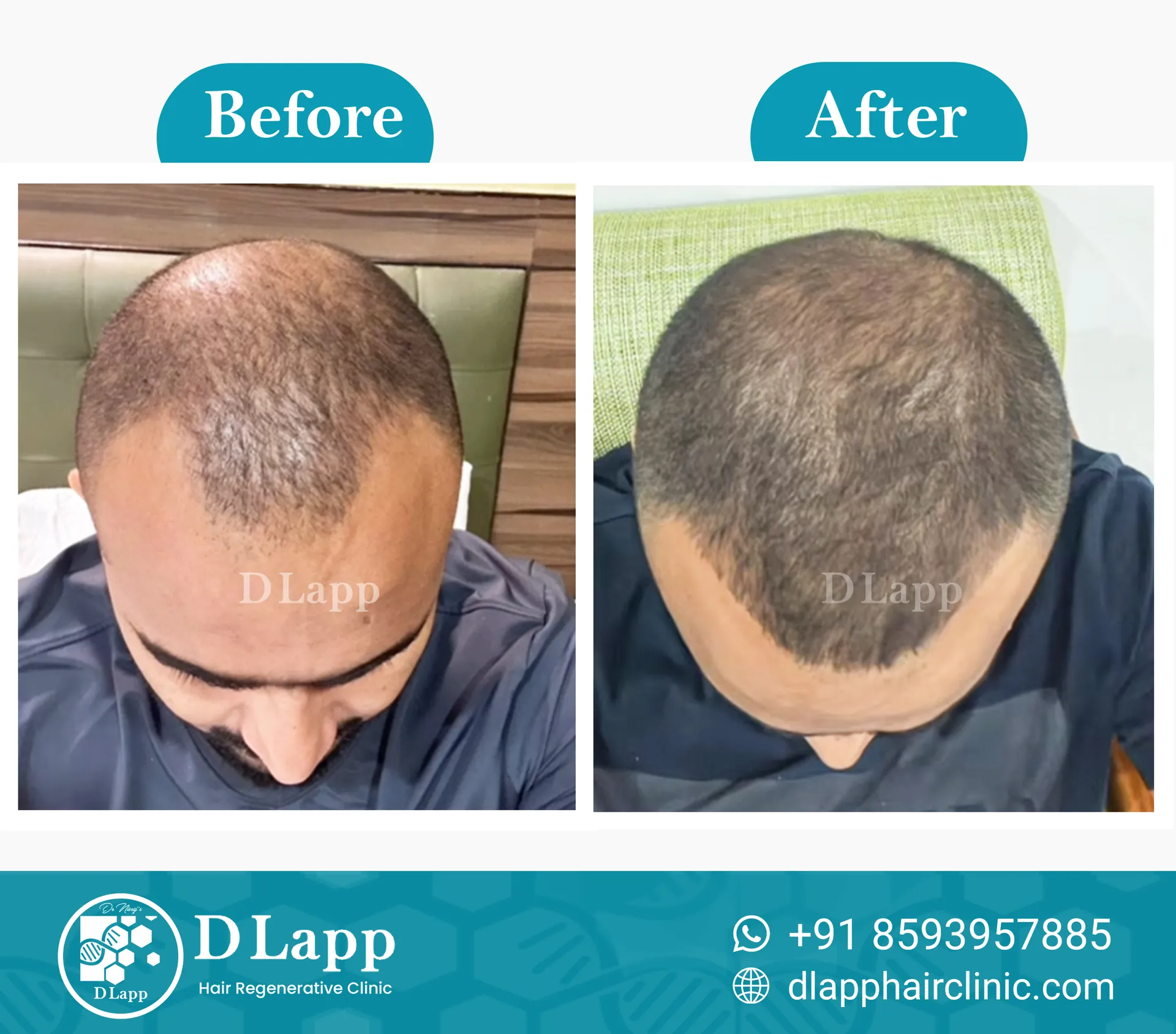 Before/After Medical Image