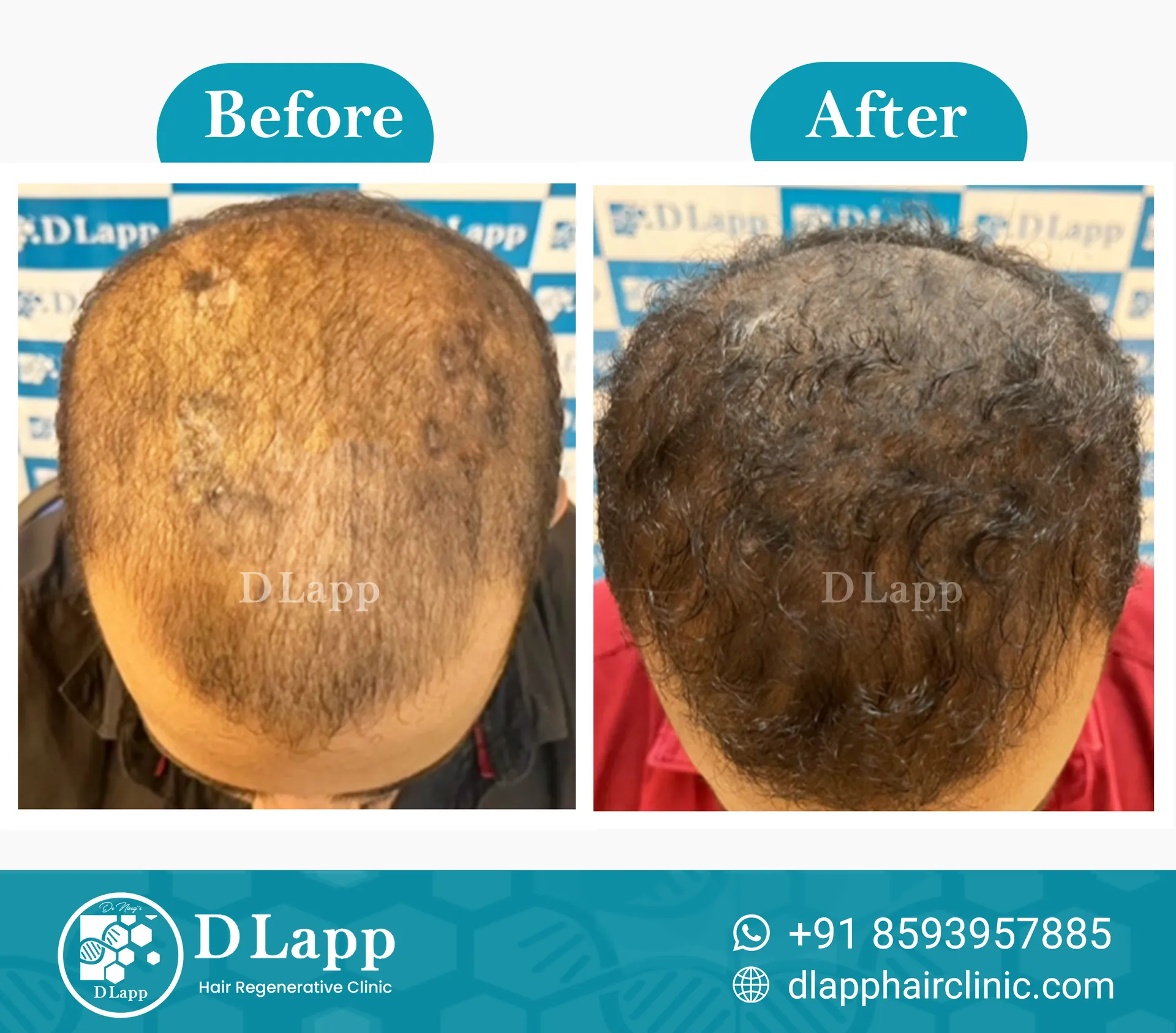 Before/After Medical Image