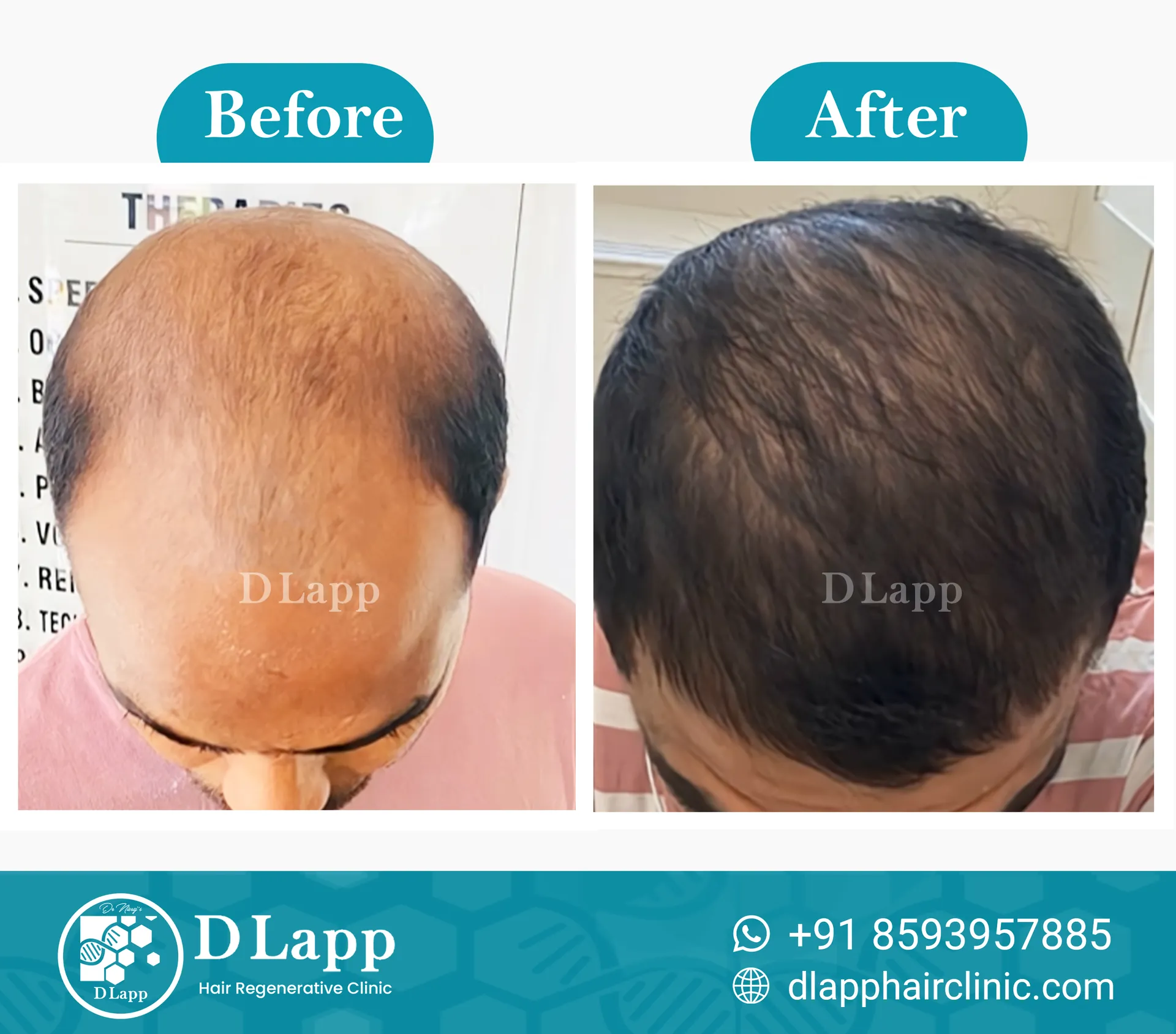 Before/After Medical Image