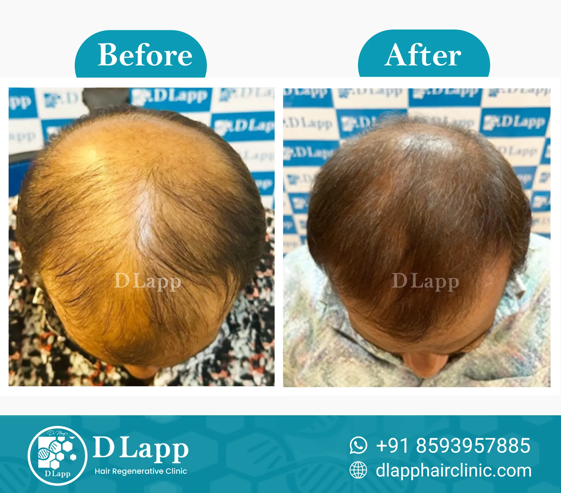Before/After Medical Image