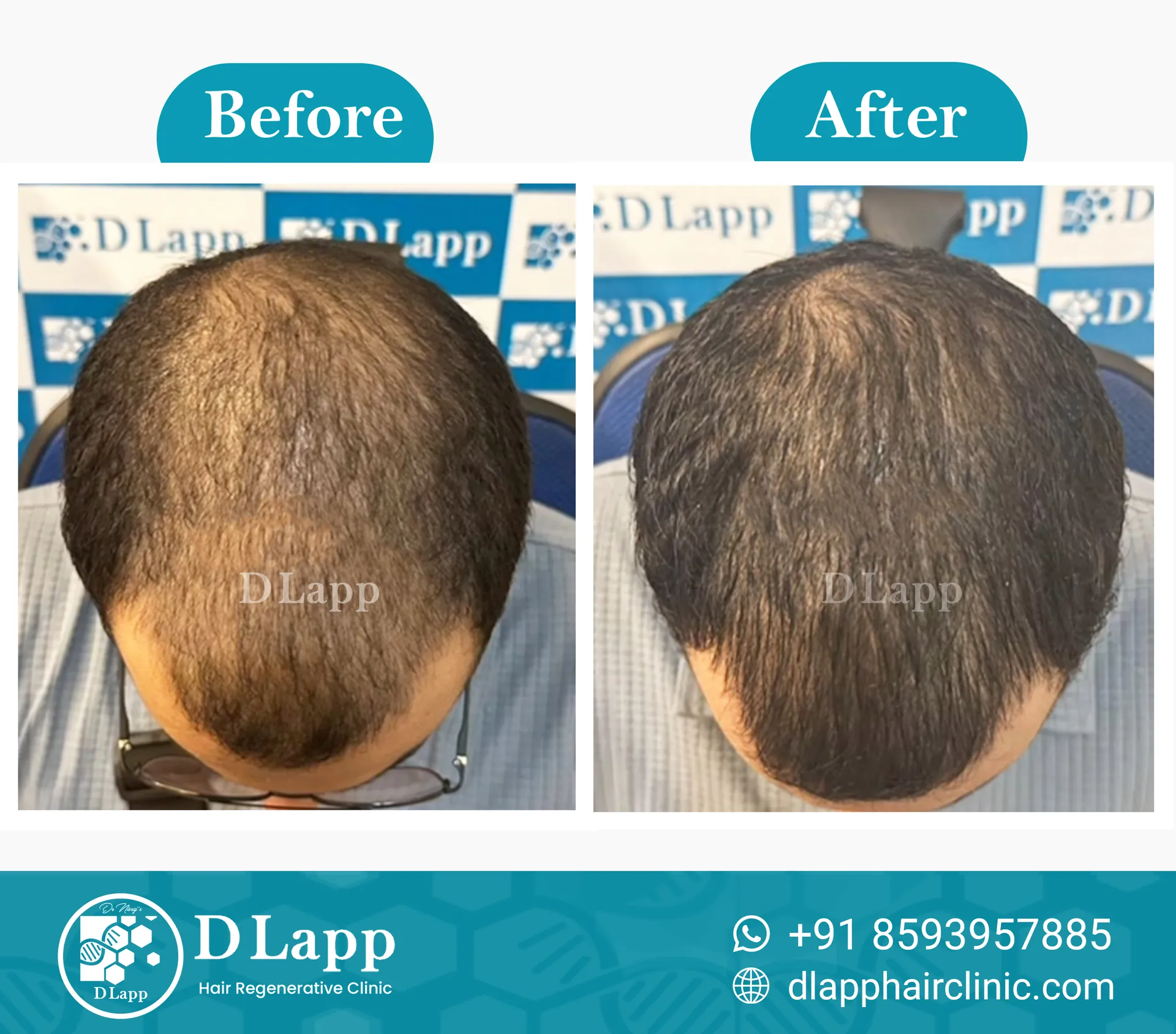 Before/After Medical Image