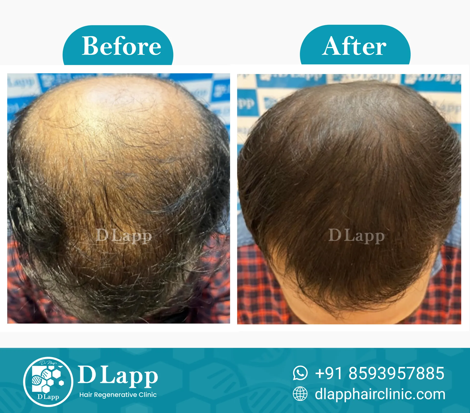 Before/After Medical Image