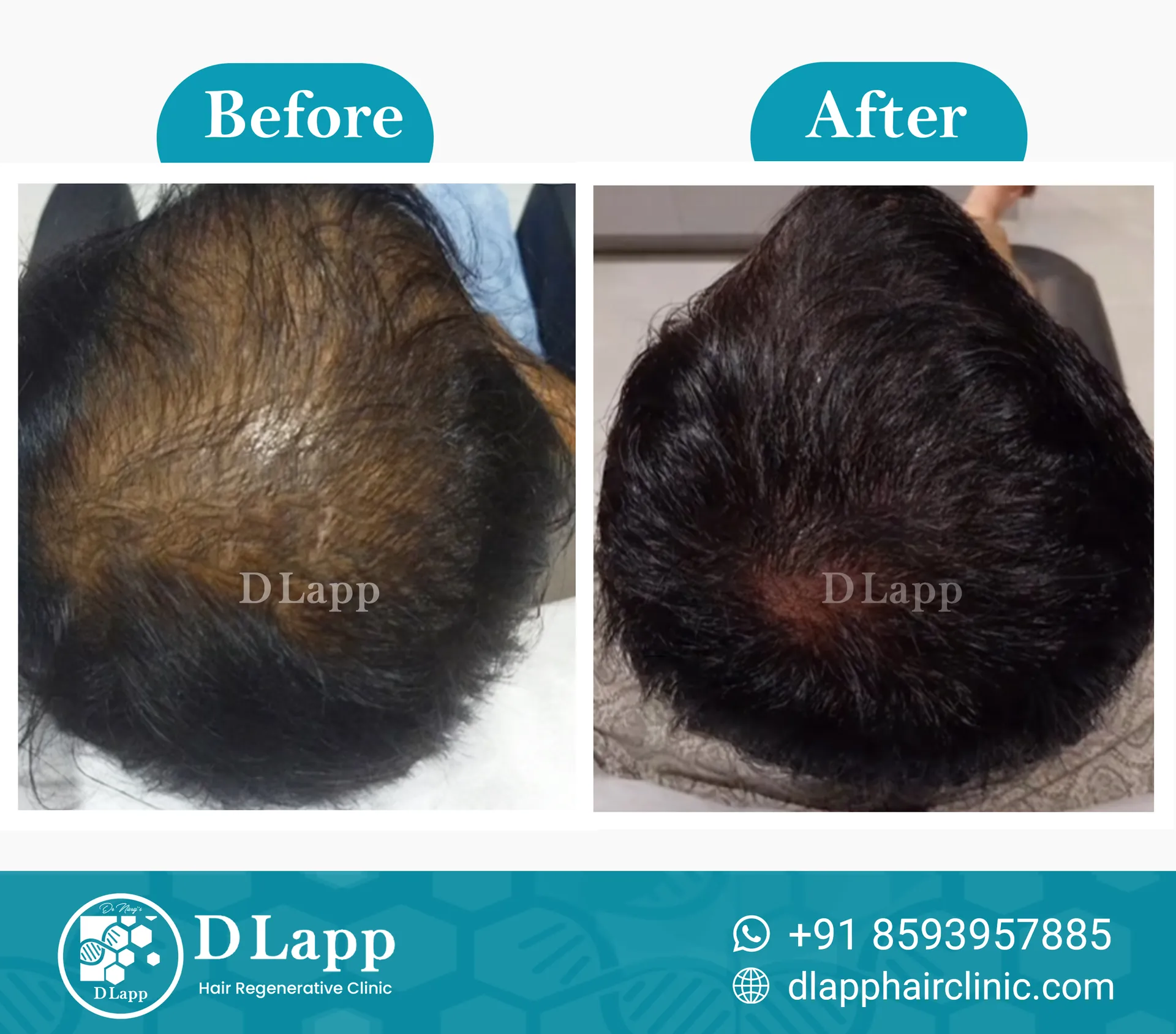 Before/After Medical Image