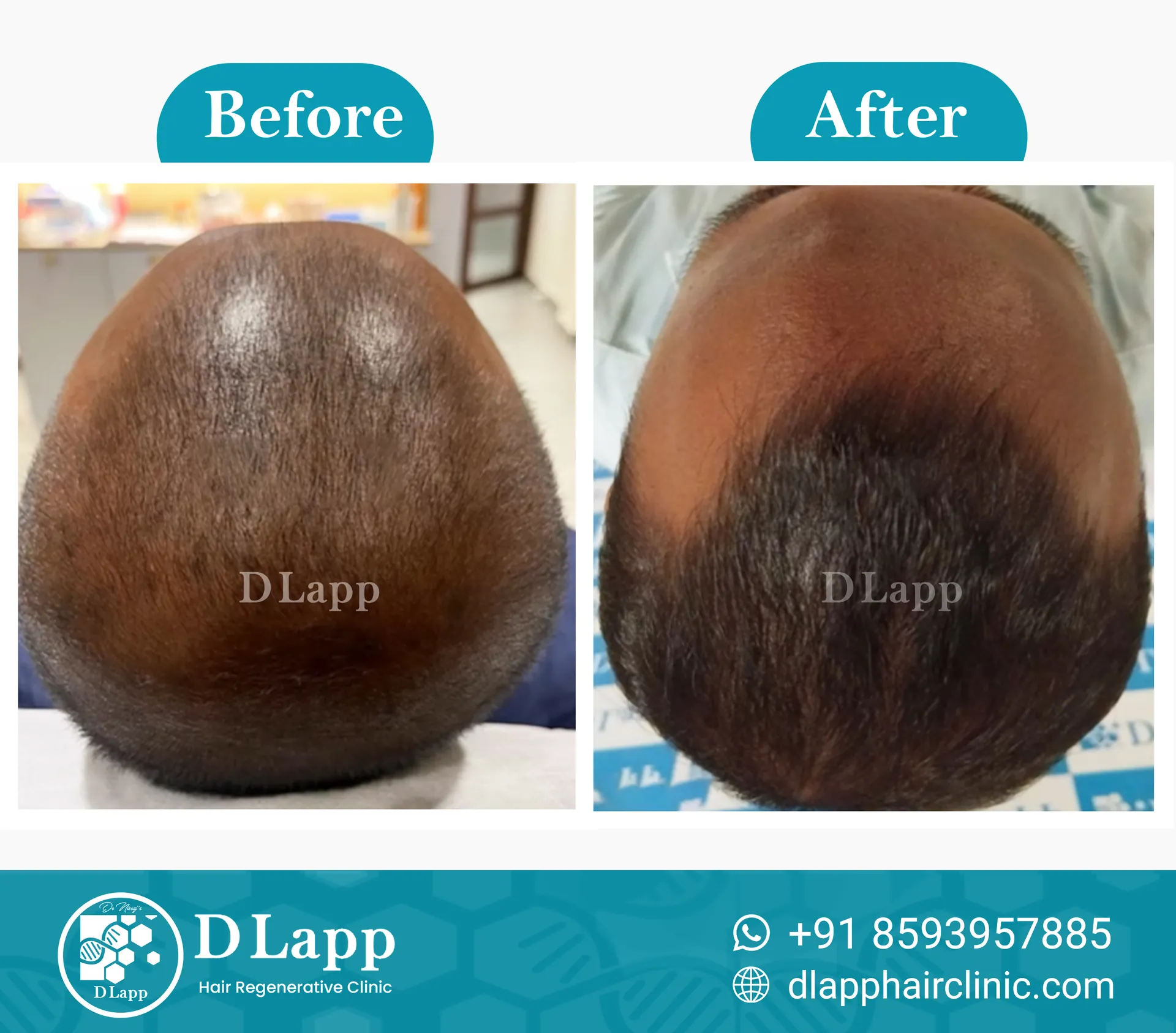 Before/After Medical Image