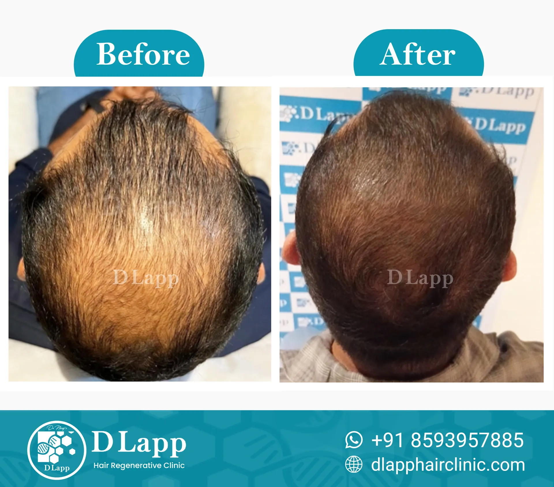Before/After Medical Image