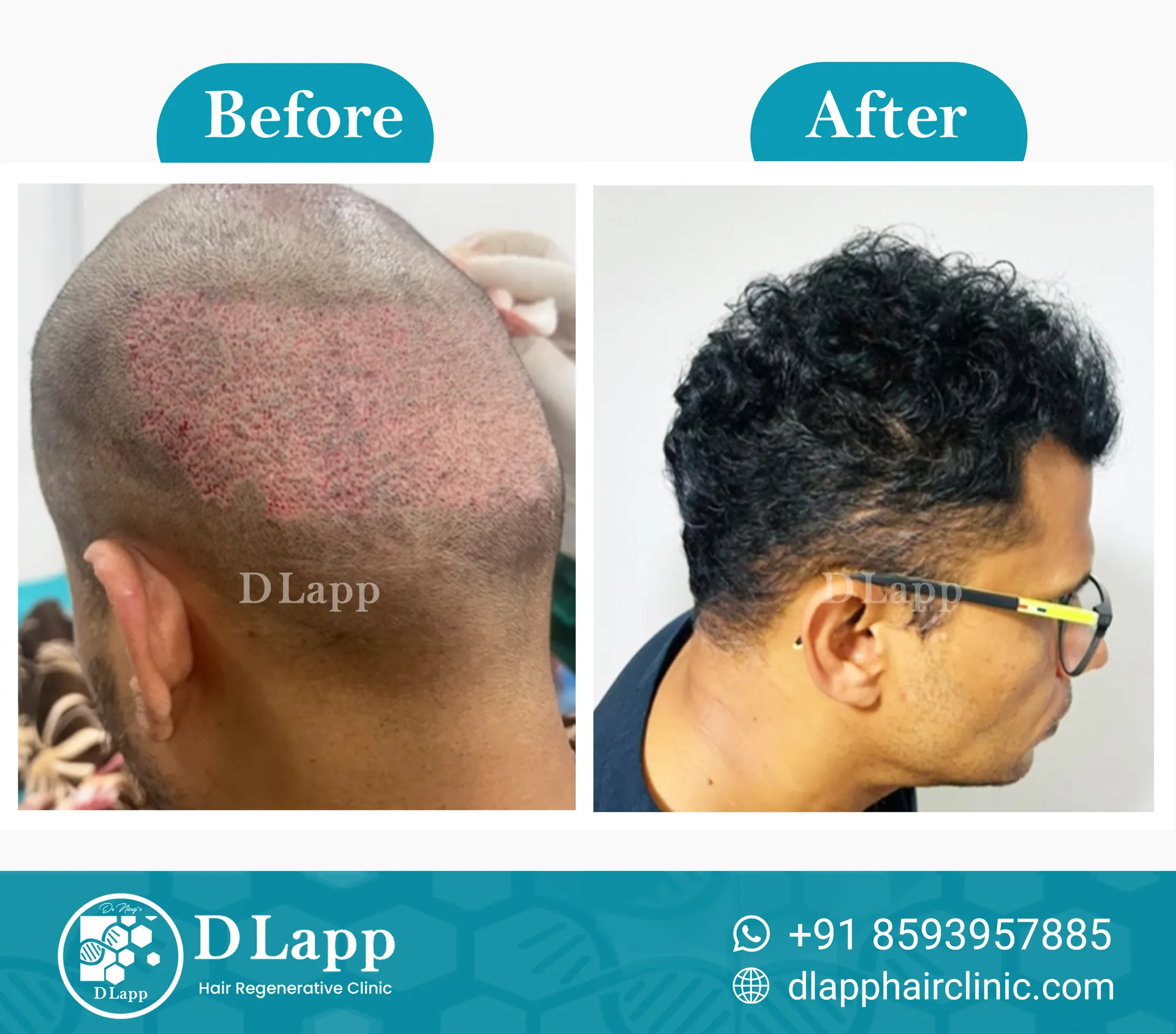 Before/After Medical Image