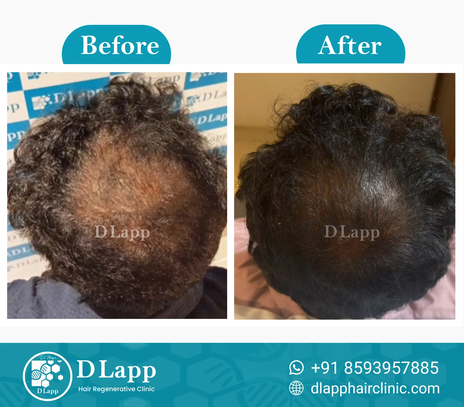 Before/After Medical Image