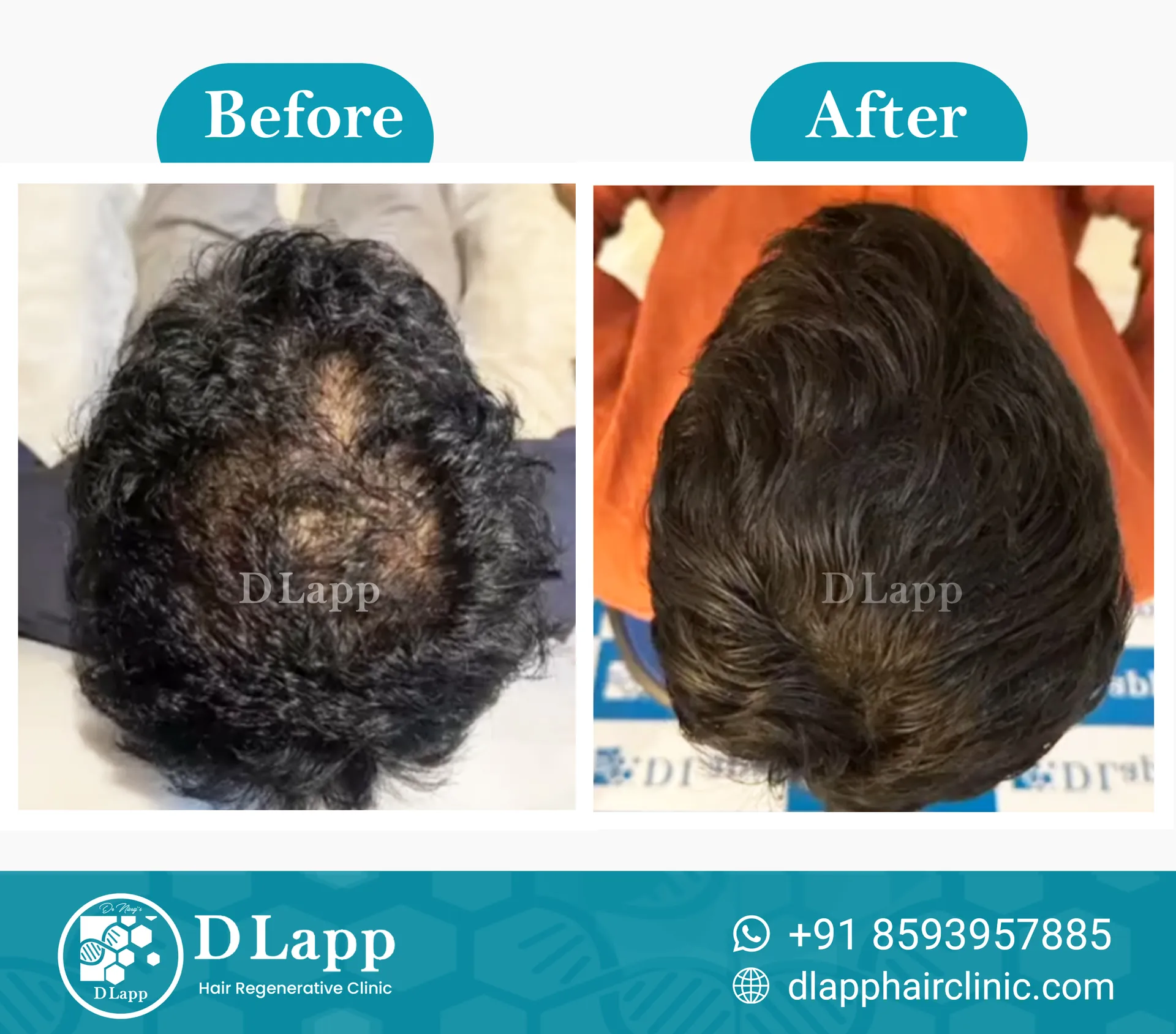 Before/After Medical Image