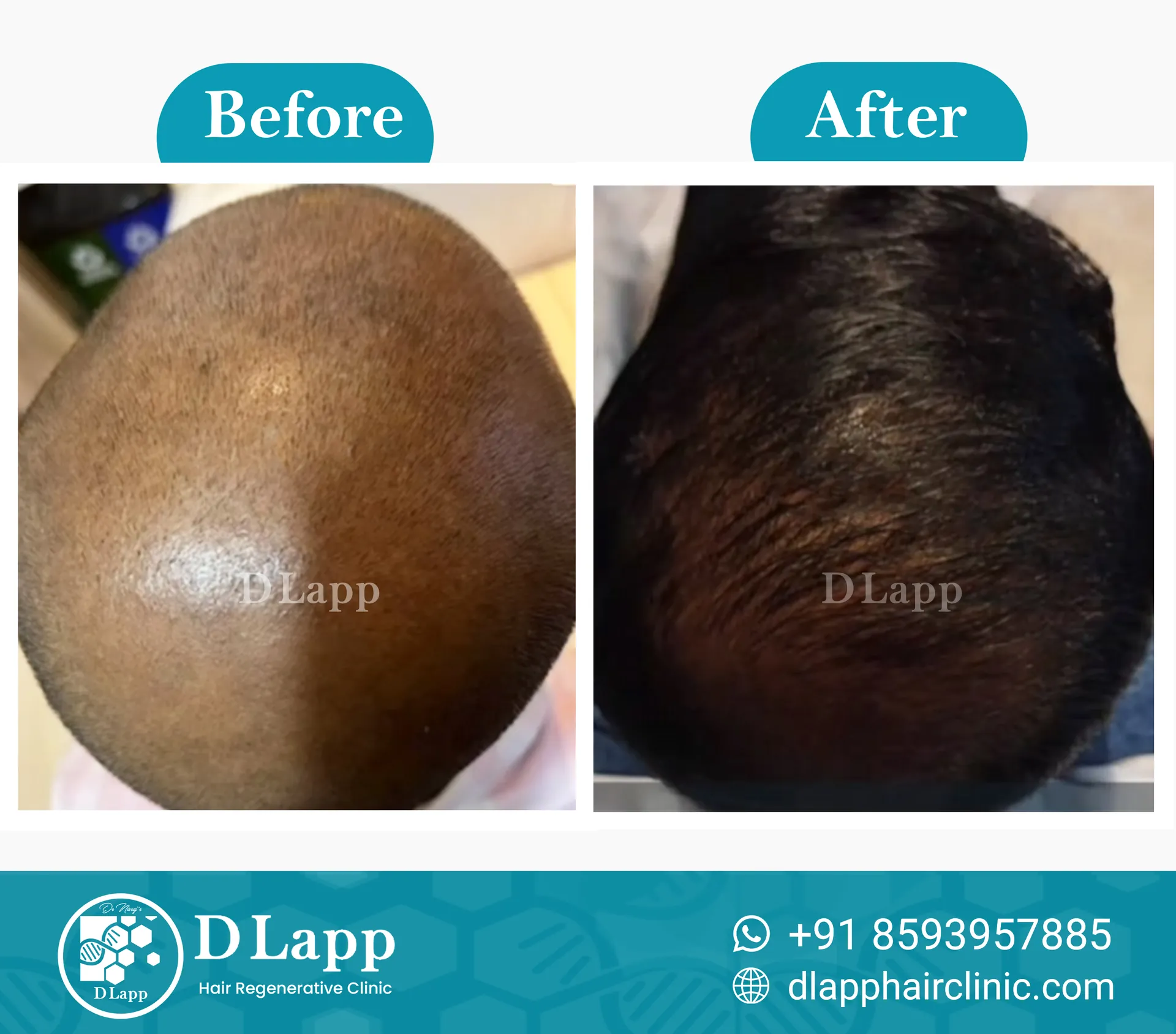 Before/After Medical Image