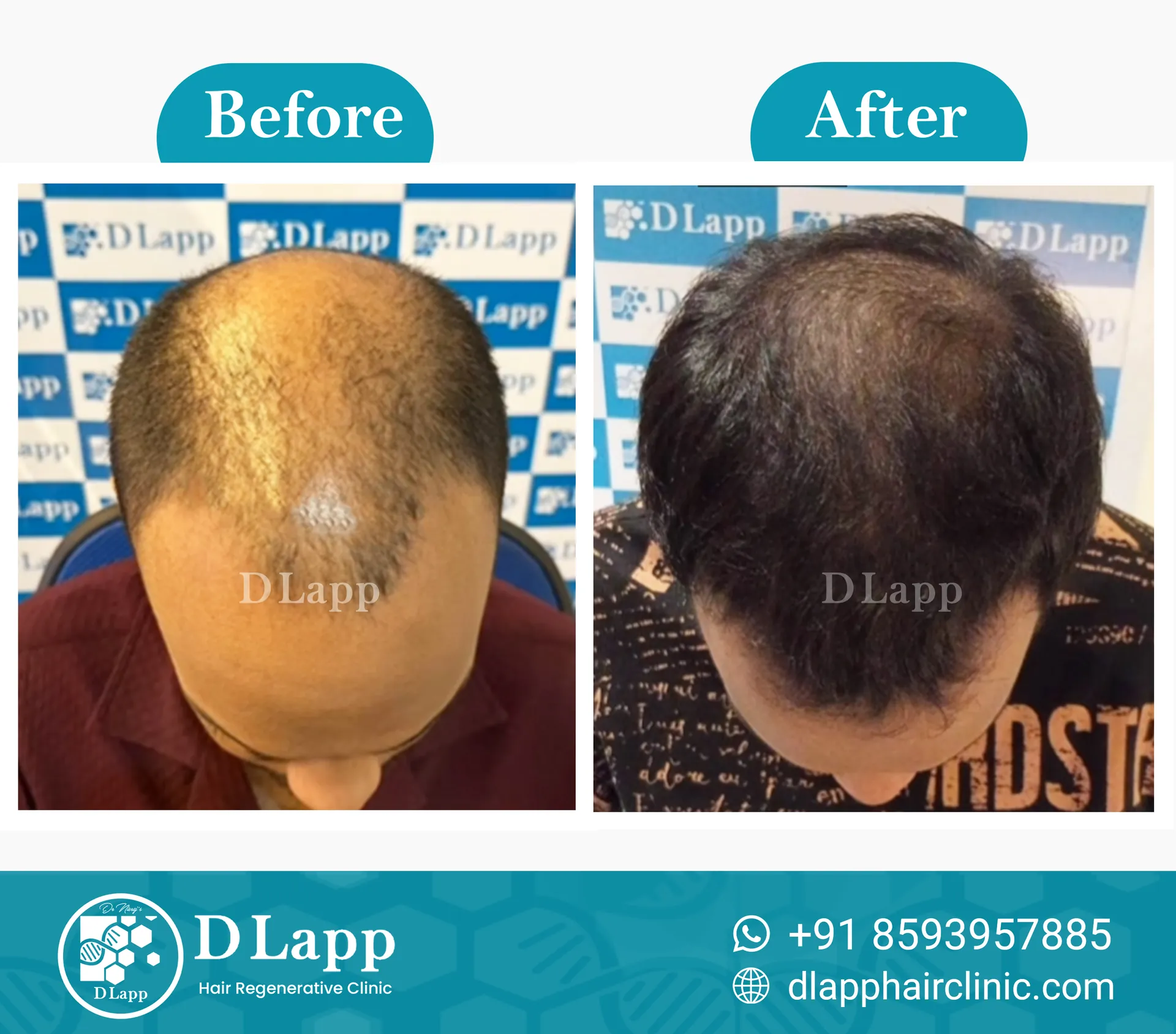 Before/After Medical Image