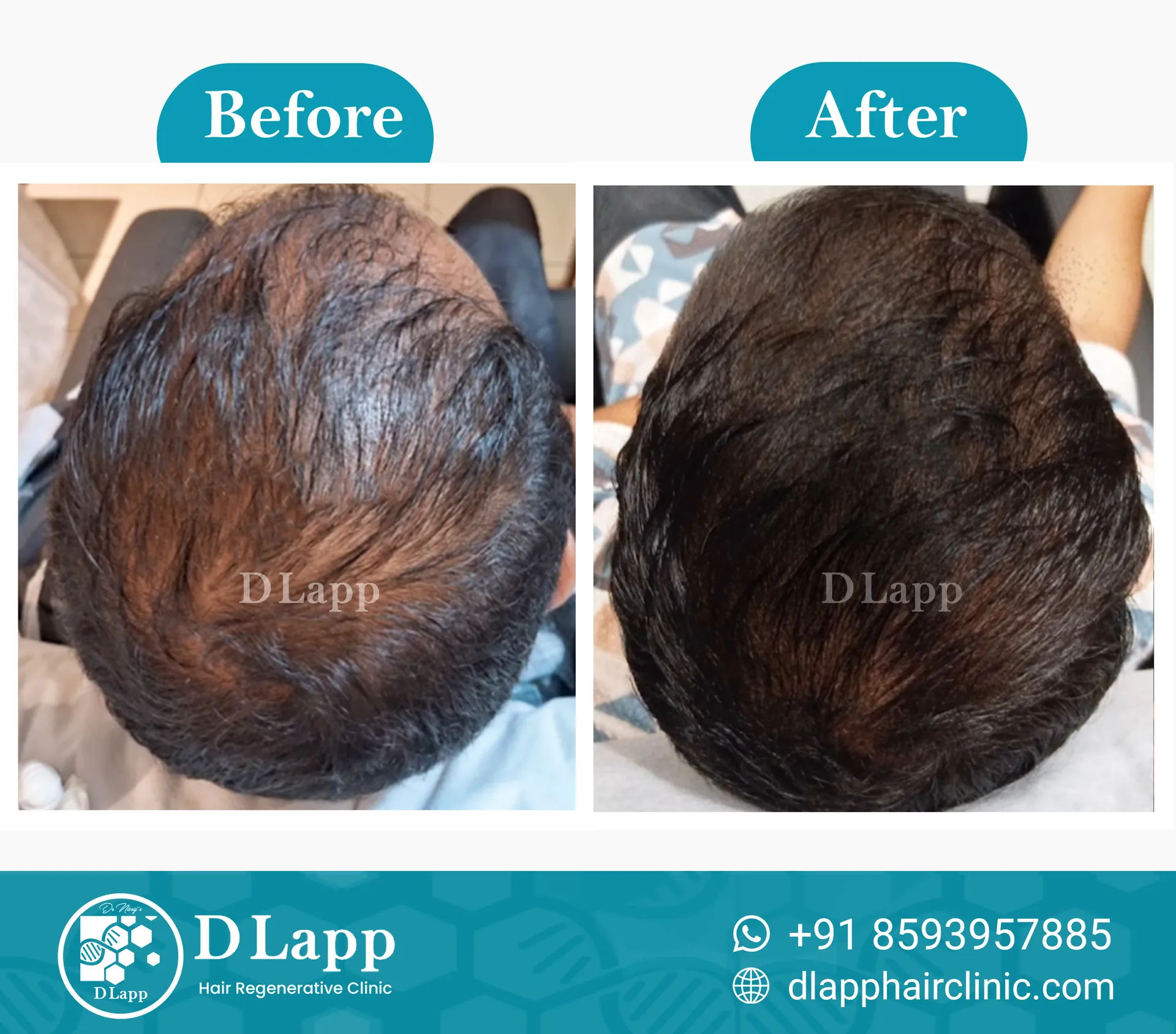 Before/After Medical Image