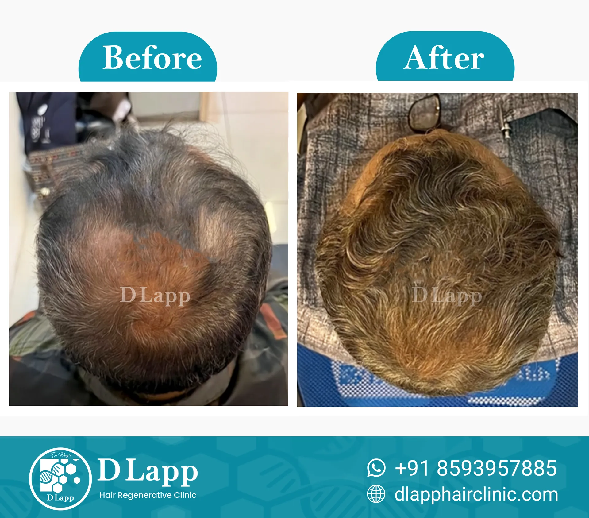 Before/After Medical Image