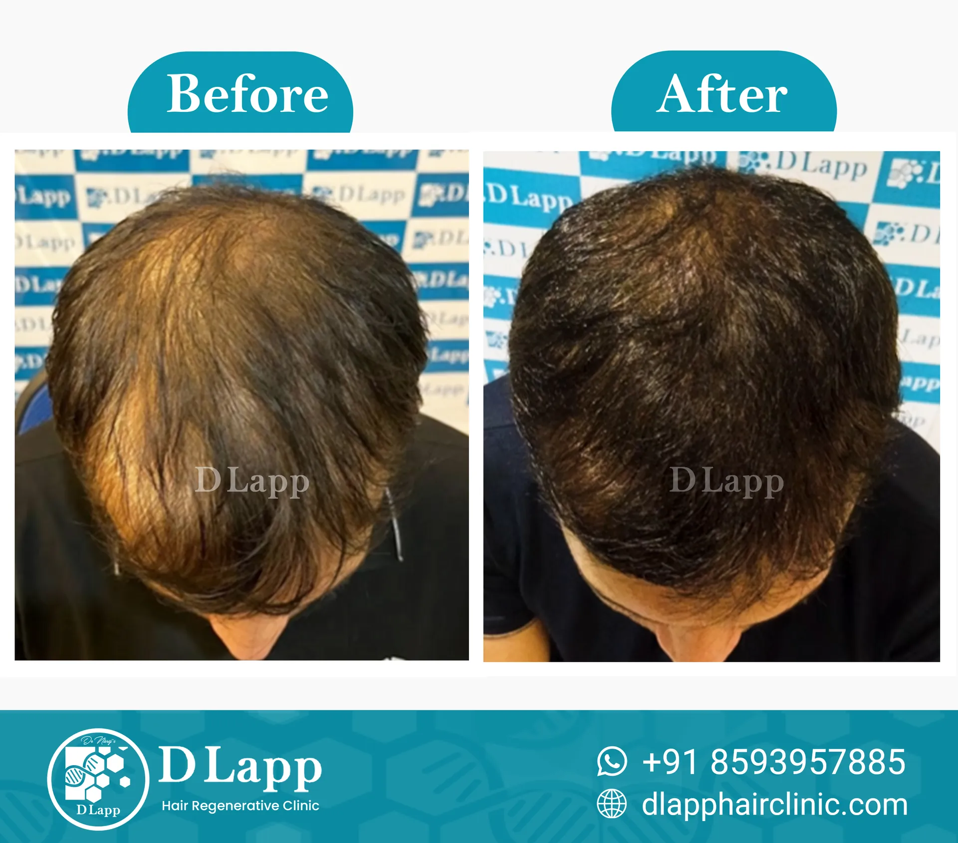 Before/After Medical Image