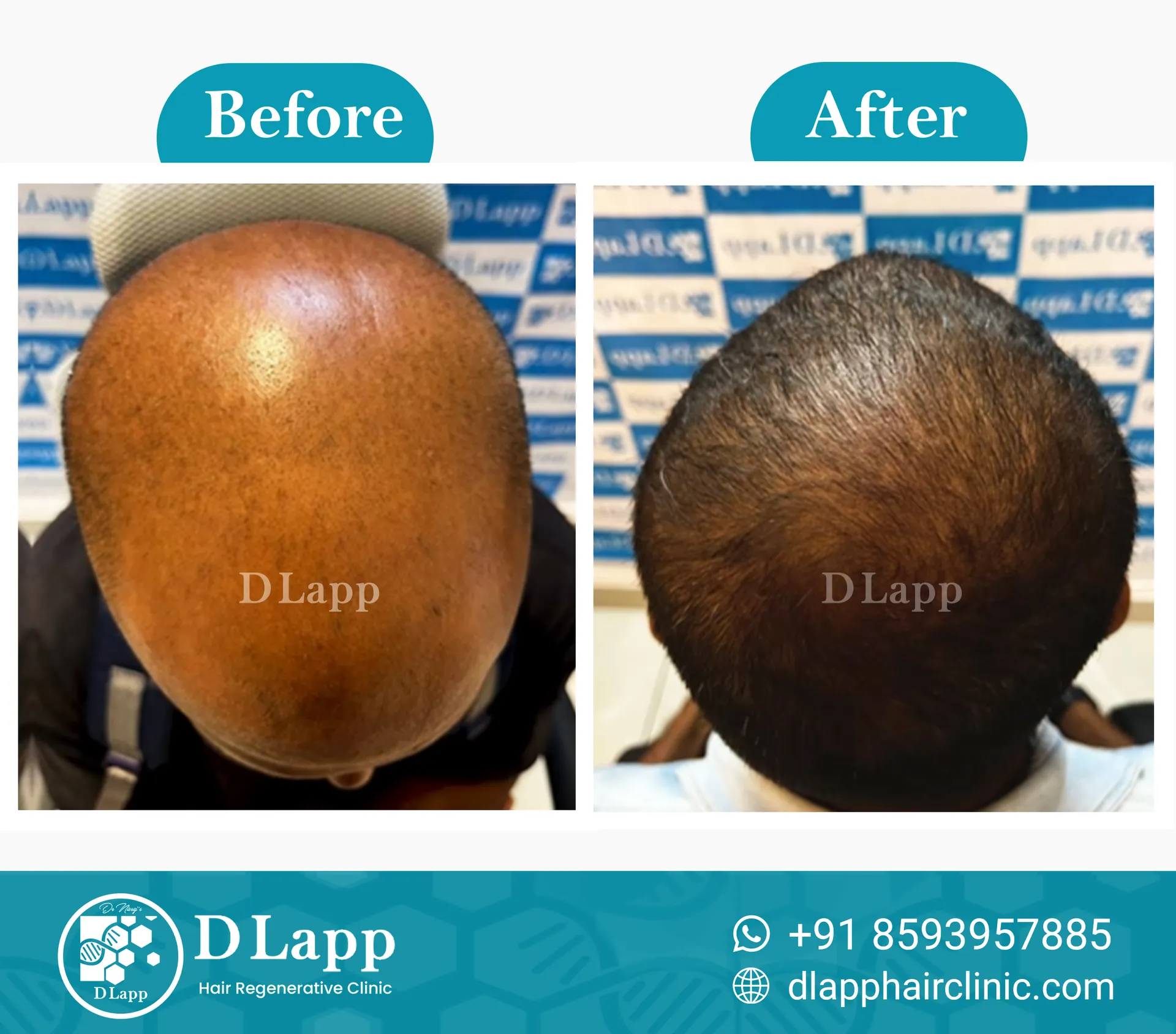 Before/After Medical Image