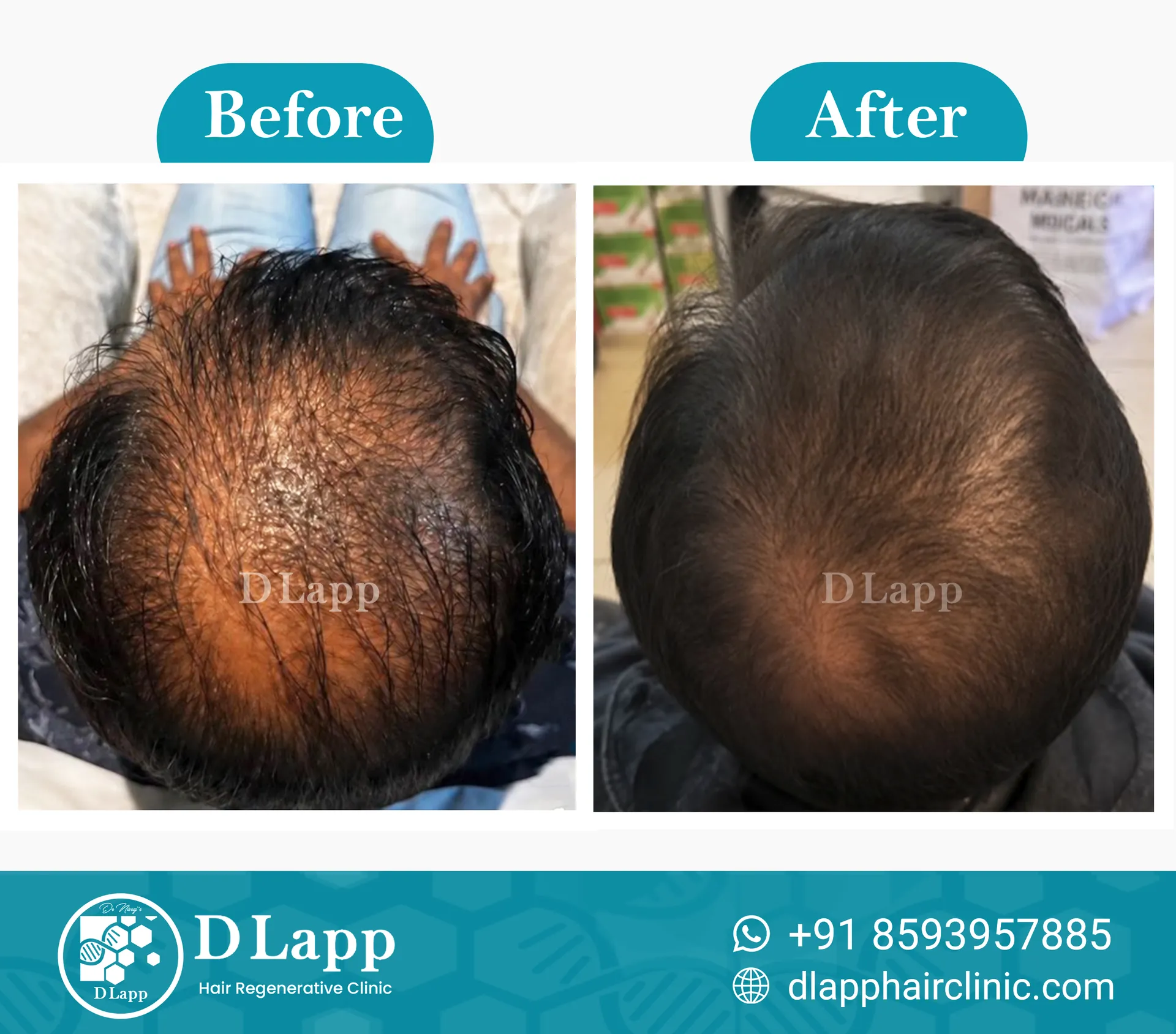 Before/After Medical Image