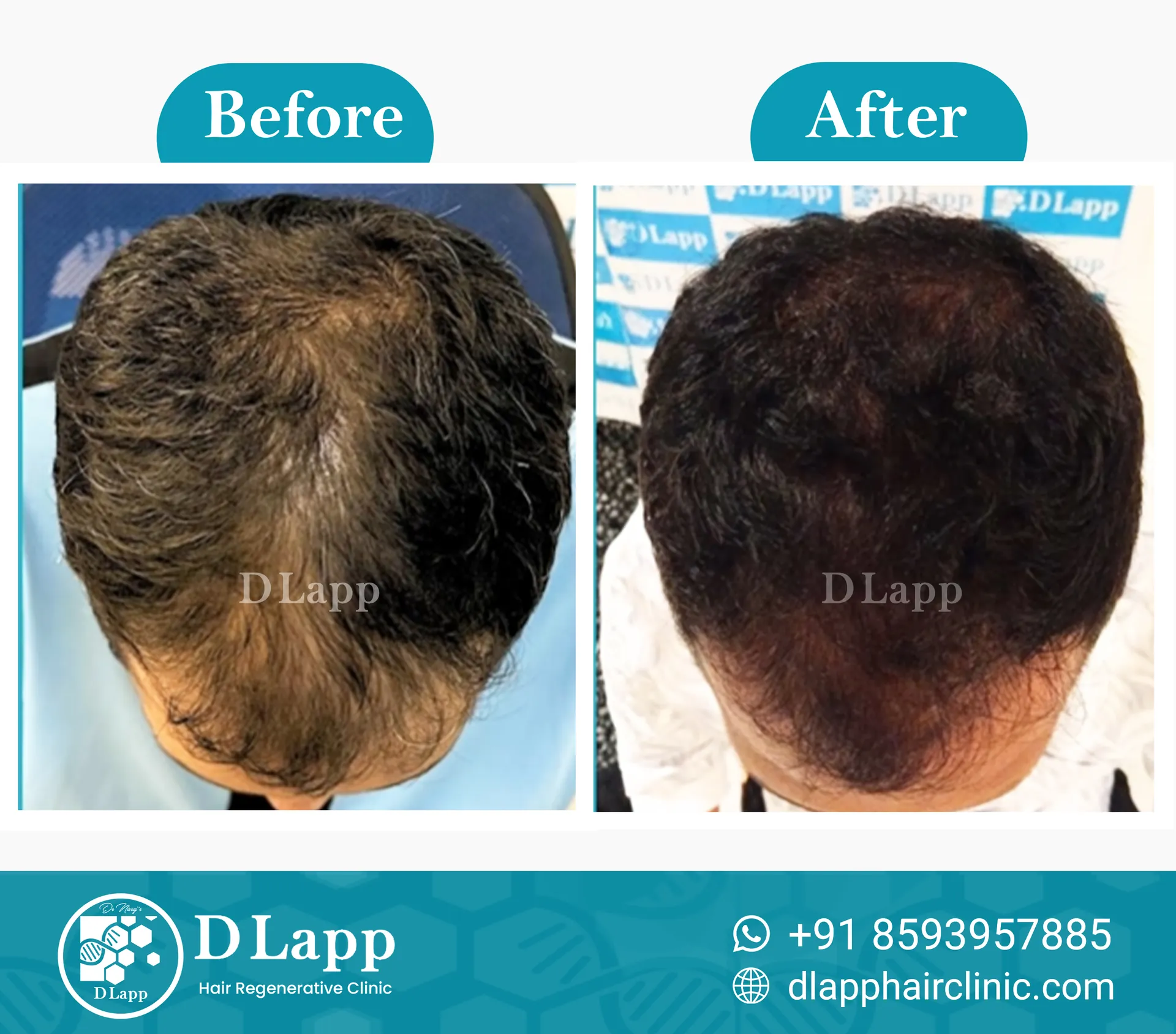 Before/After Medical Image