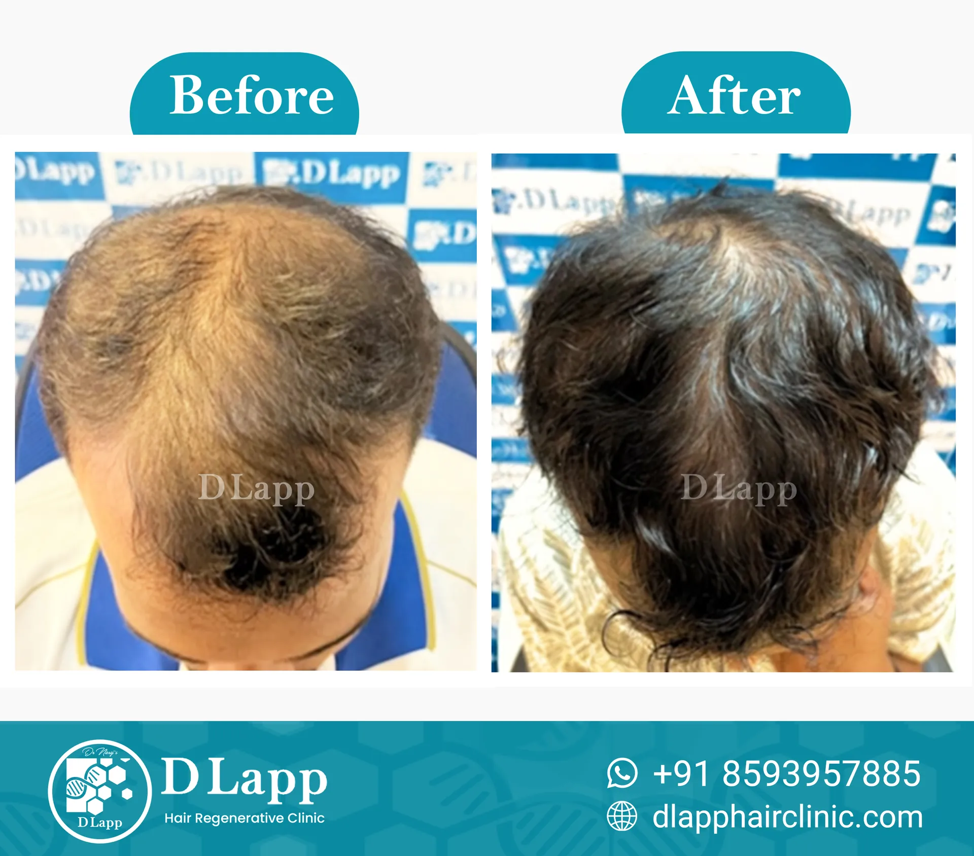 Before/After Medical Image
