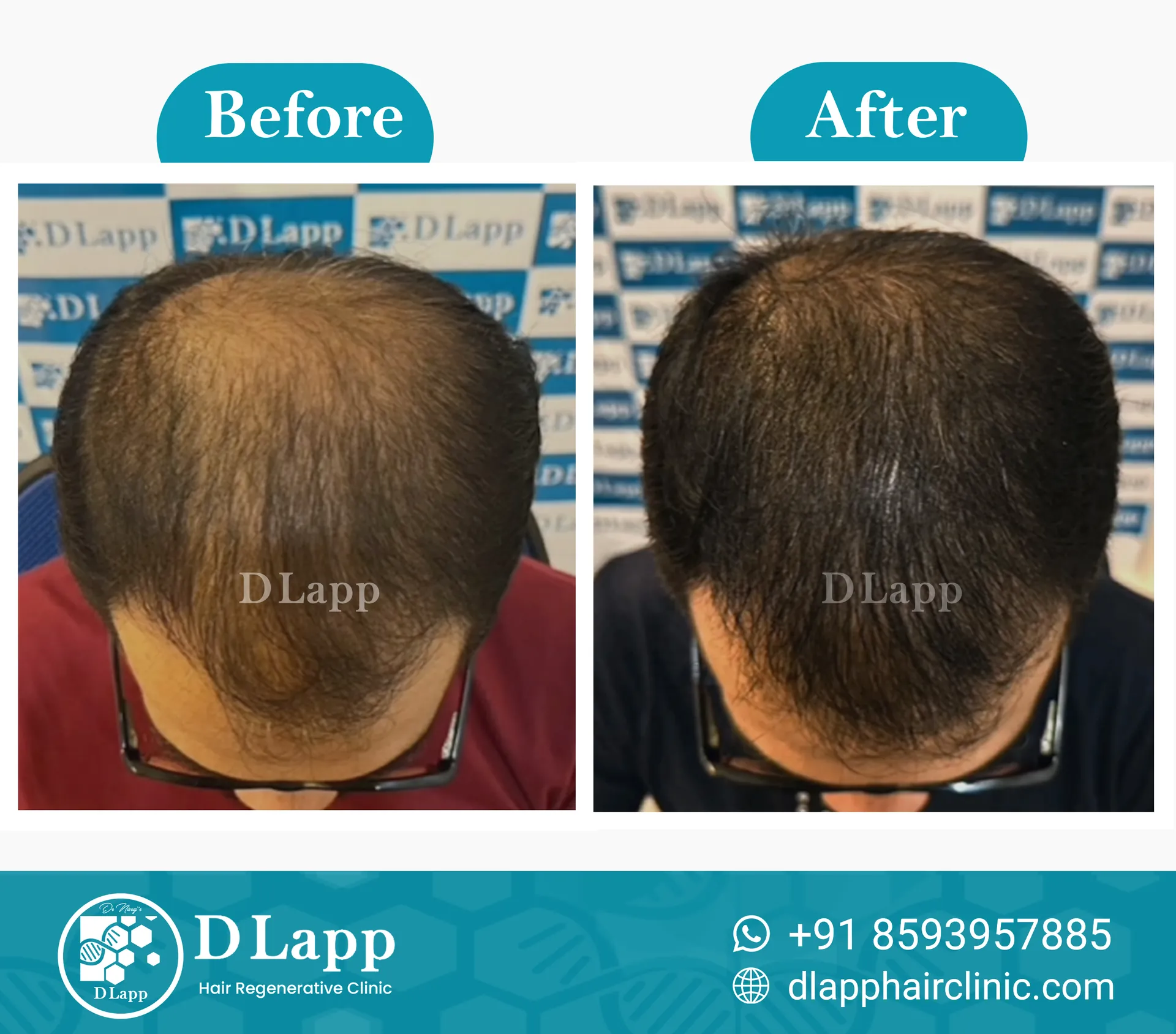 Before/After Medical Image