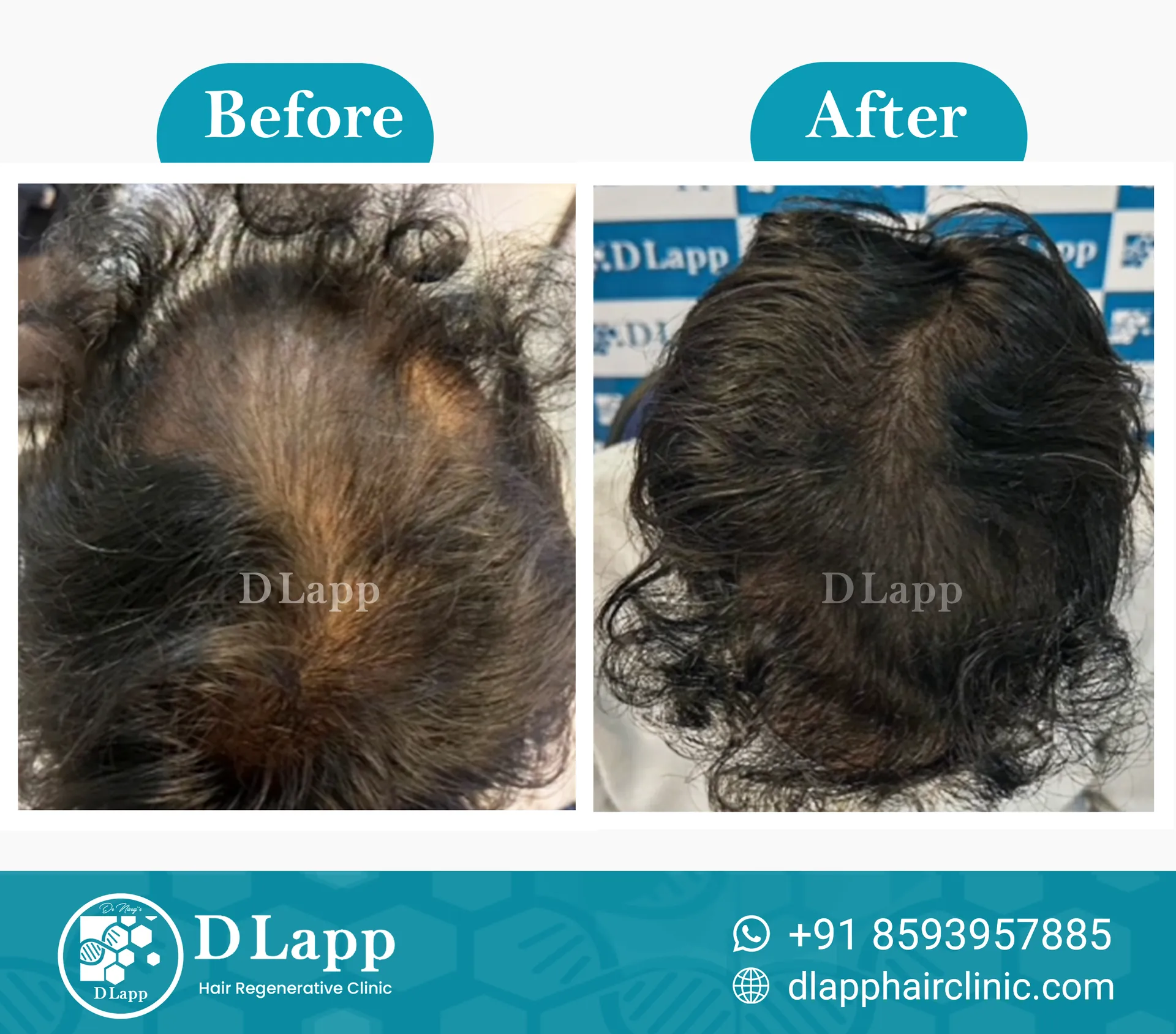 Before/After Medical Image