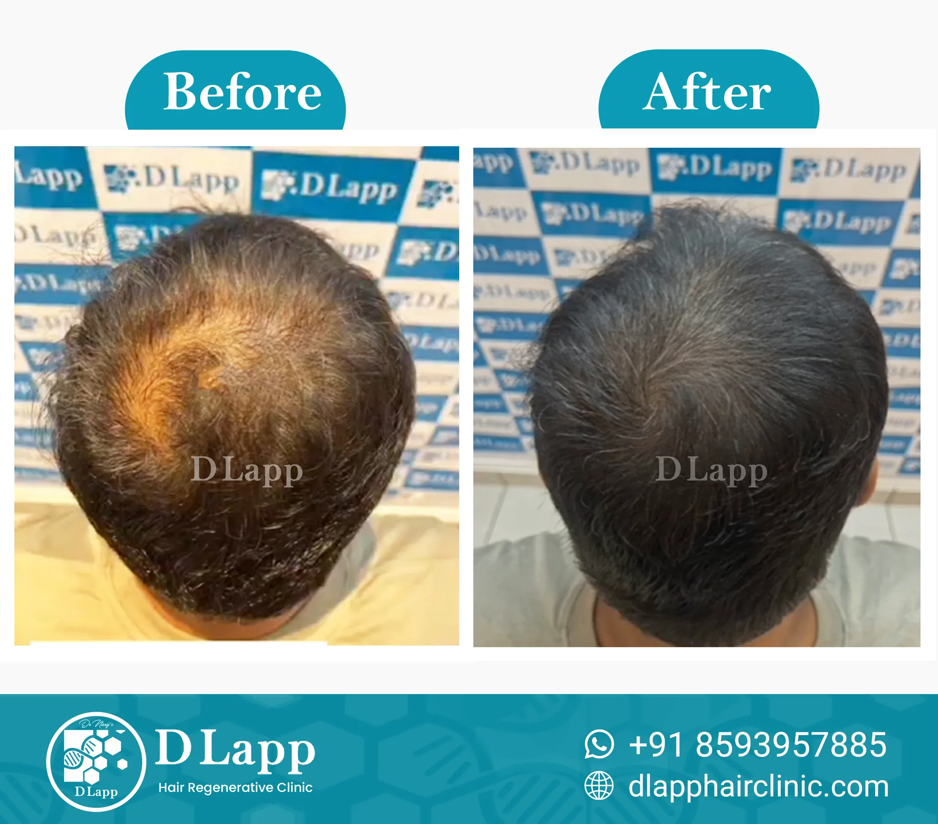 Before/After Medical Image