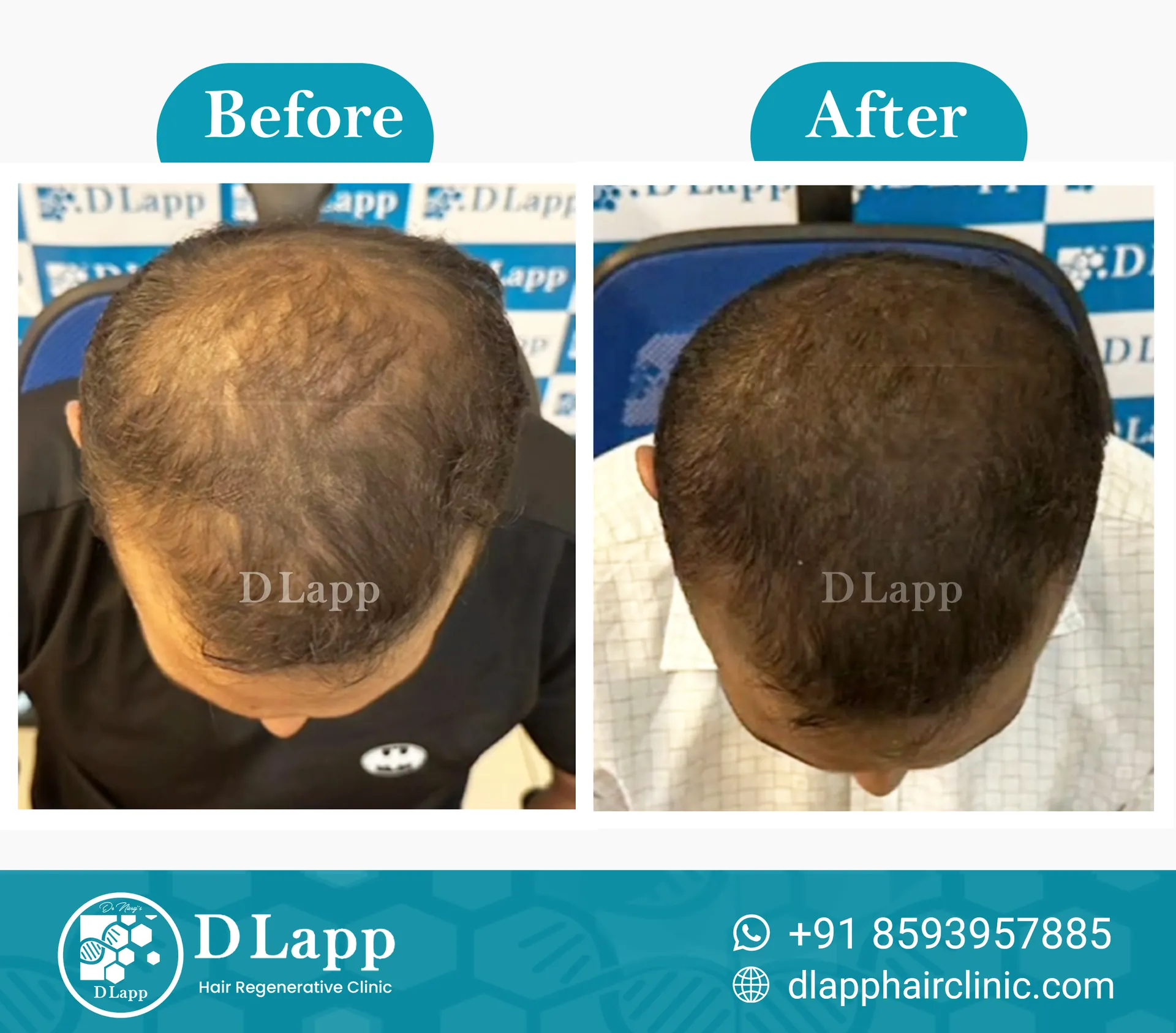 Before/After Medical Image