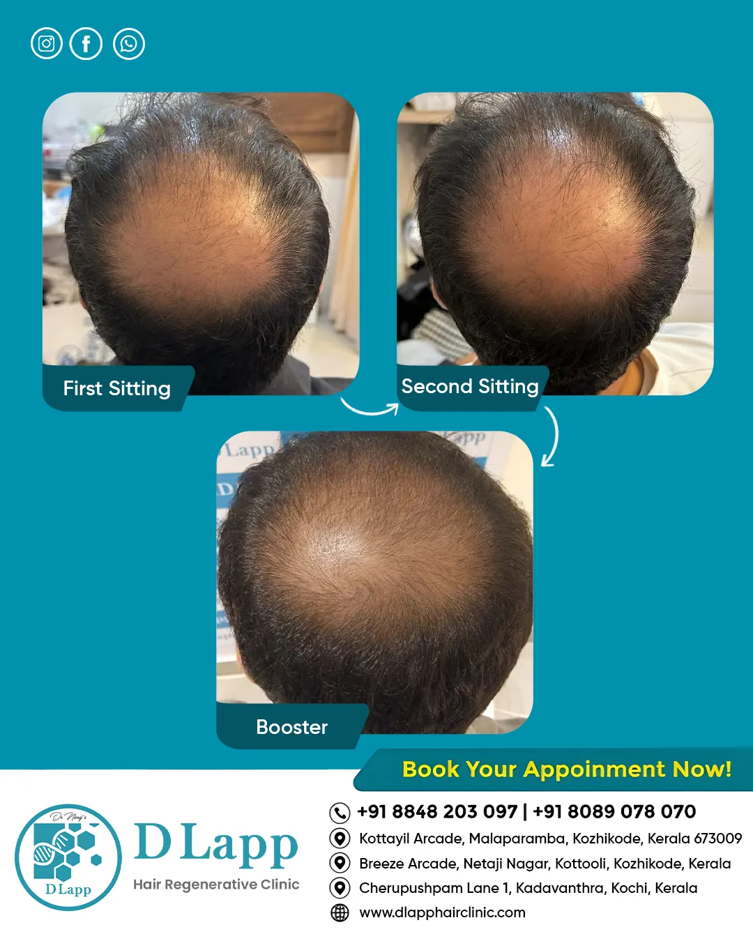Before/After Medical Image