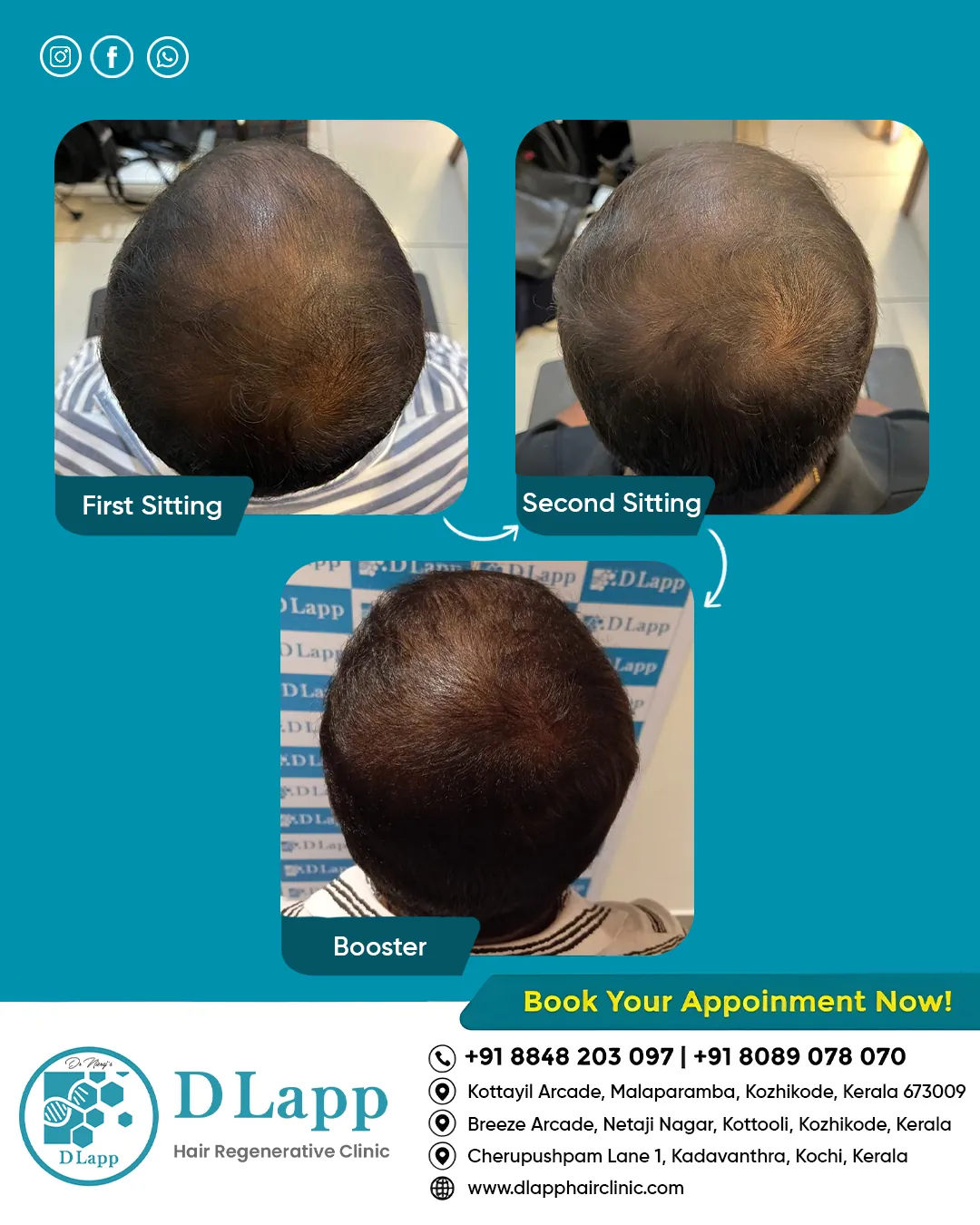 Before/After Medical Image