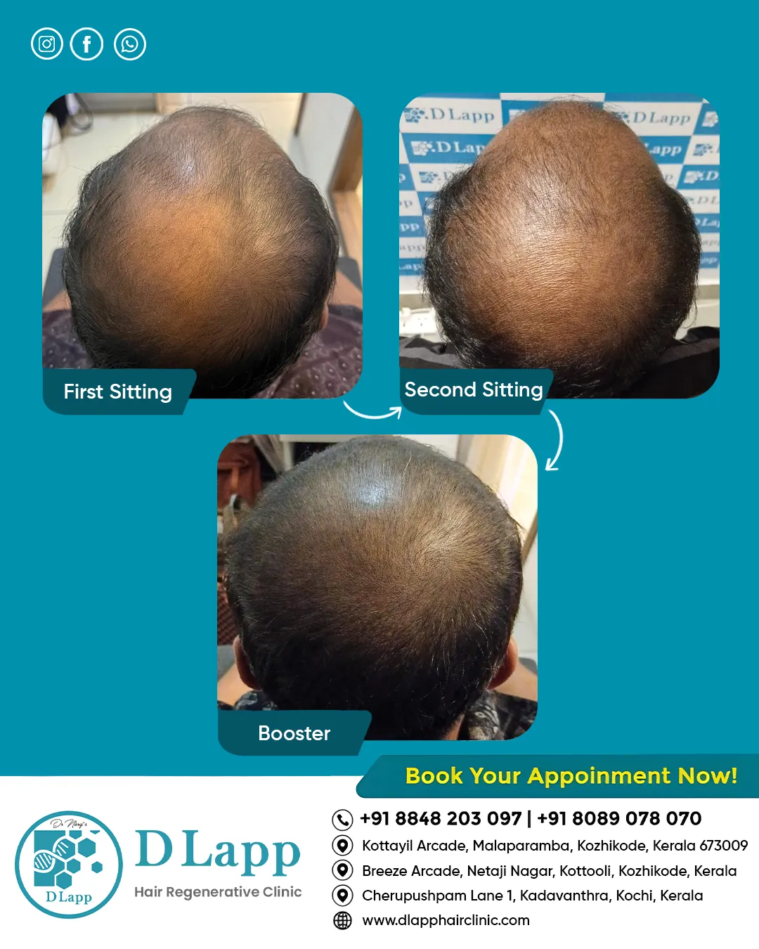Before/After Medical Image