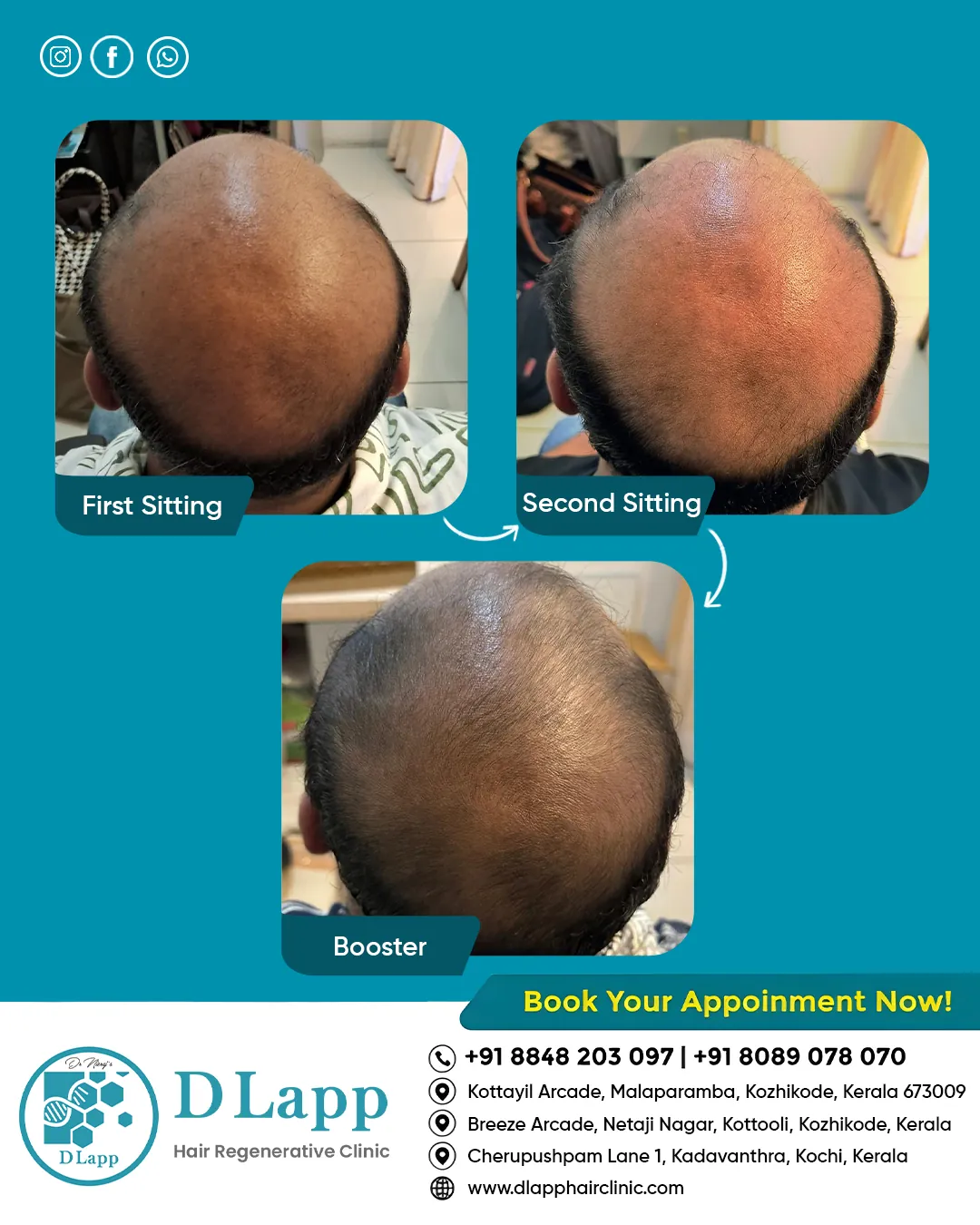 Before/After Medical Image