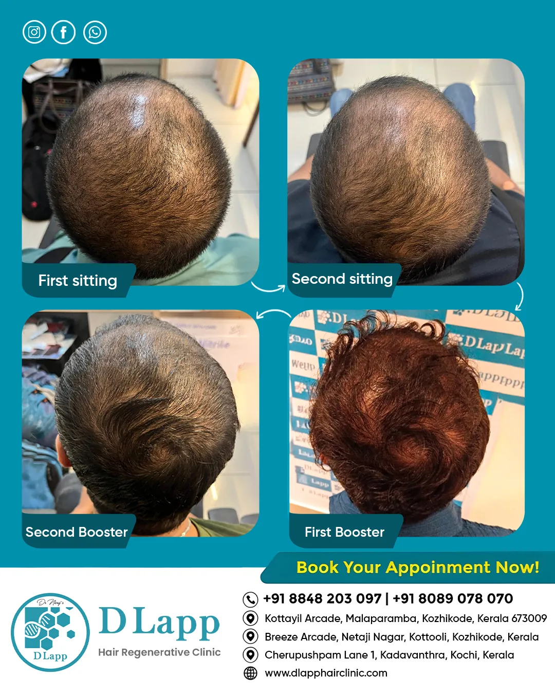 Before/After Medical Image