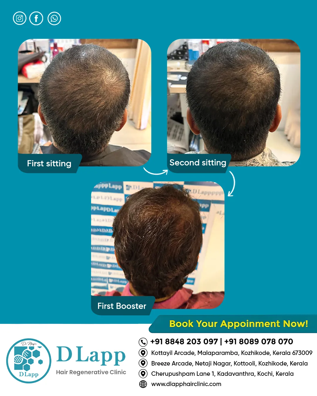 Before/After Medical Image