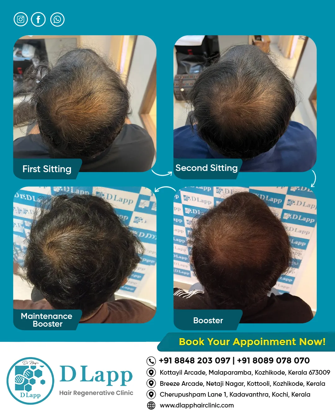 Before/After Medical Image