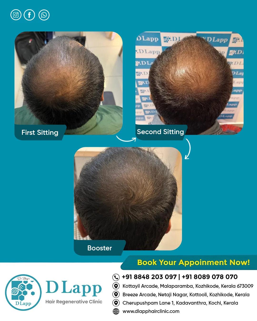 Before/After Medical Image